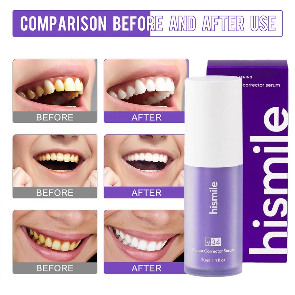 30ml Hismile V34 Purple Teeth  - Teeth Whitening Foam 리뷰 및 가격