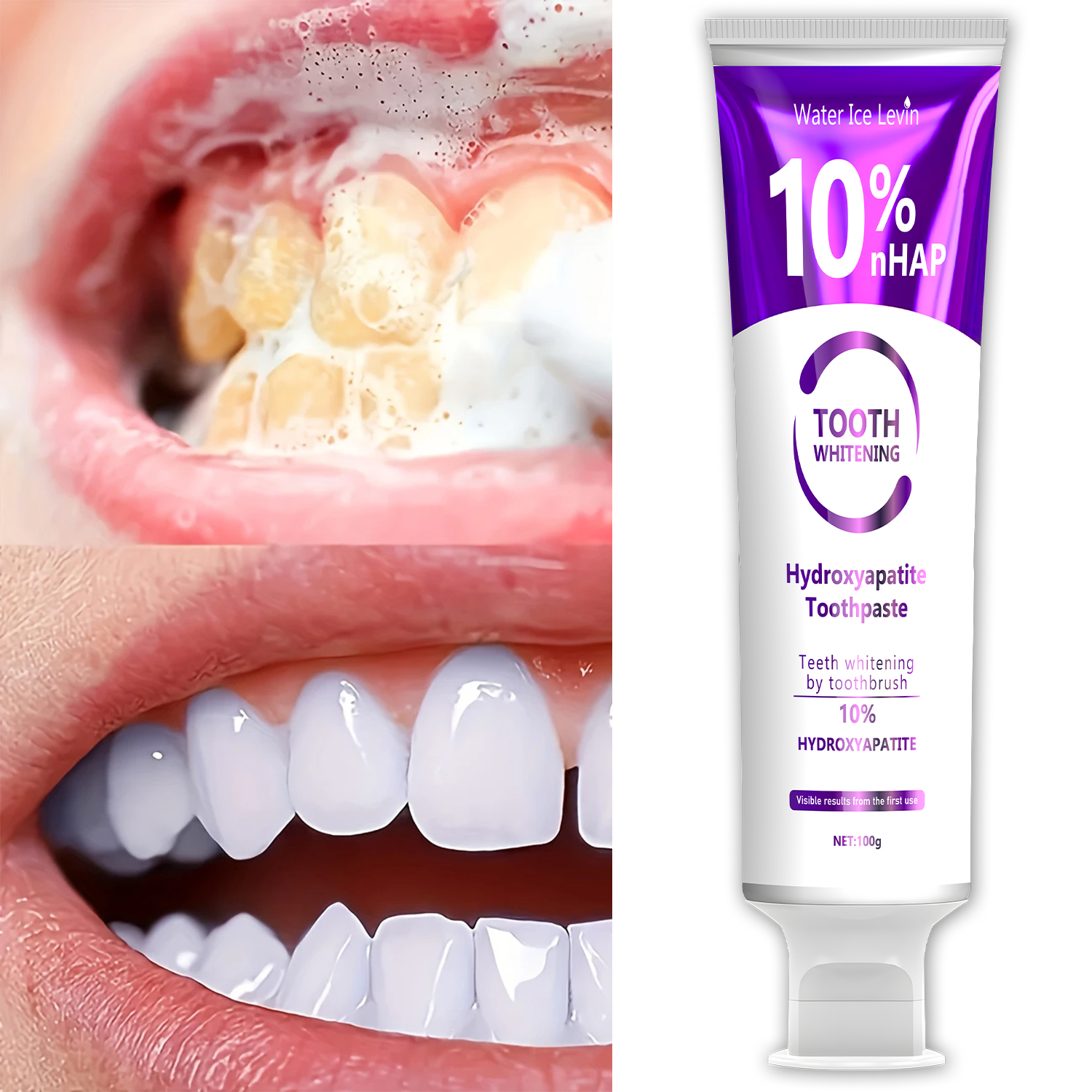 10% Nanoh Hydrogen Oxide Tooth - Teeth Whitening Foam 리뷰 및 가격