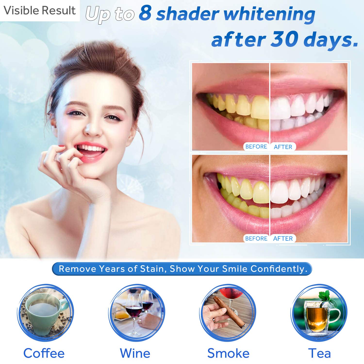 Teeth Whitening Gel Refill Syr - Teeth Whitening Foam 리뷰 및 가격