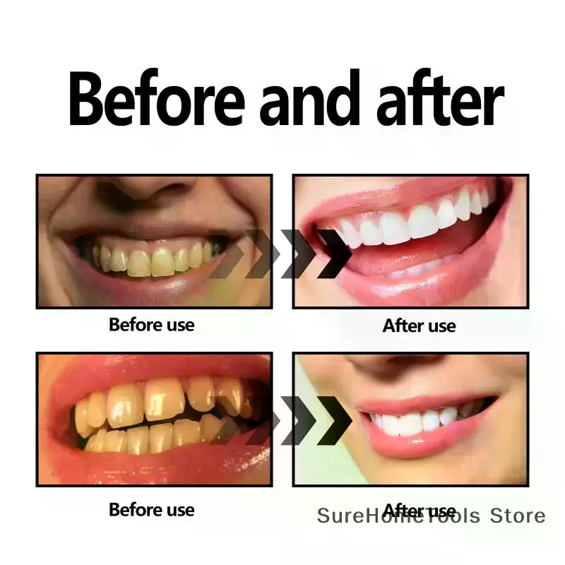 Bamboo Charcoal Powder For Tee - Teeth Whitening Ai 리뷰 및 가격