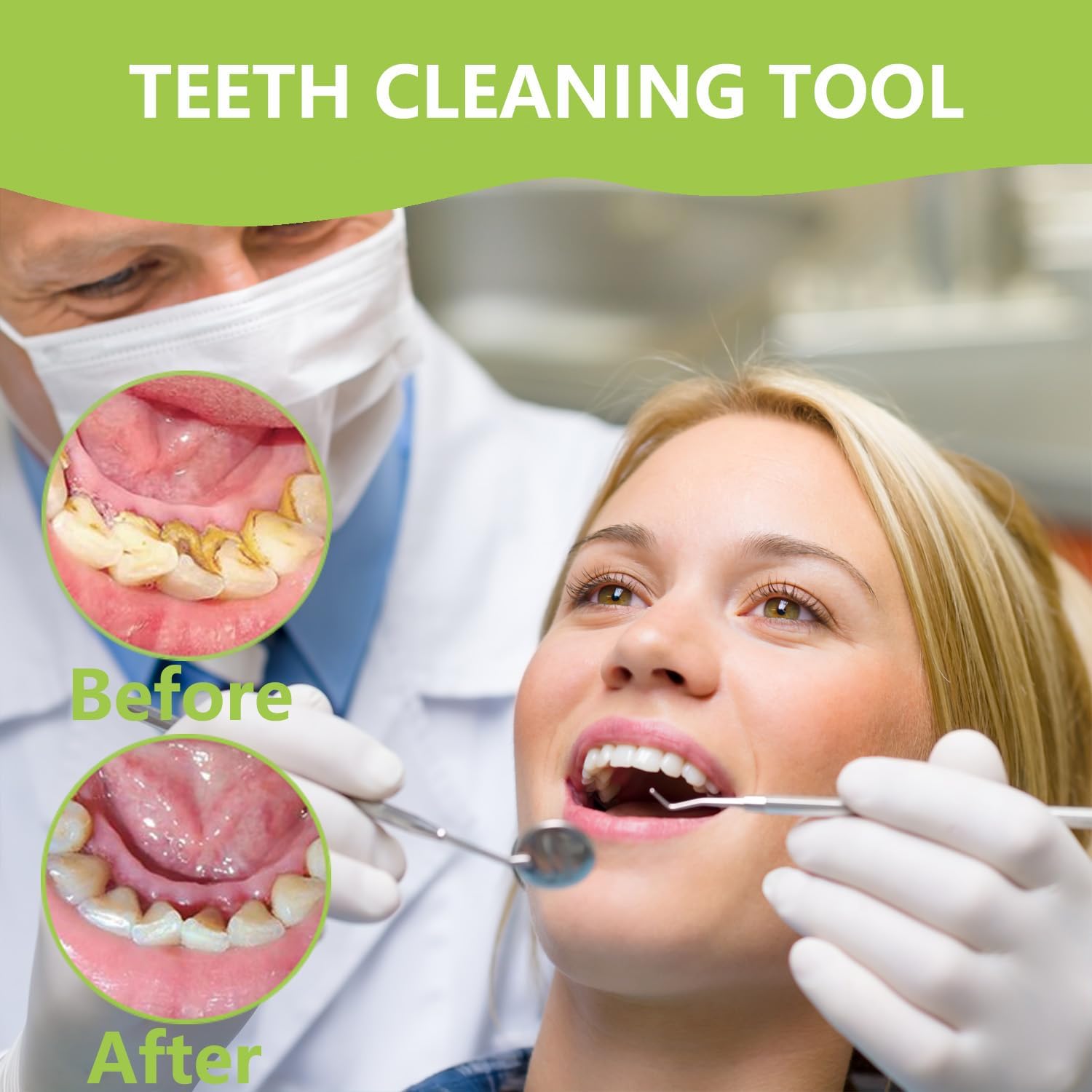 Professional Teeth Cleaning Or - Teeth Whitening Machine Professional 리뷰 및 가격