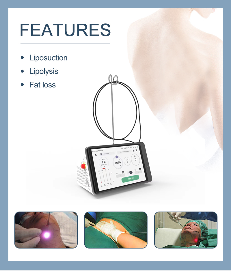Dental Laser Teeth Whitening D - Teeth Whitening Device 리뷰 및 가격