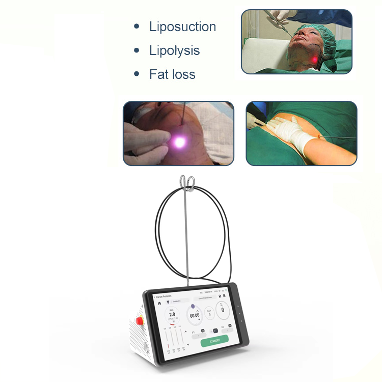 Dental Laser Teeth Whitening D - Teeth Whitening Device 리뷰 및 가격