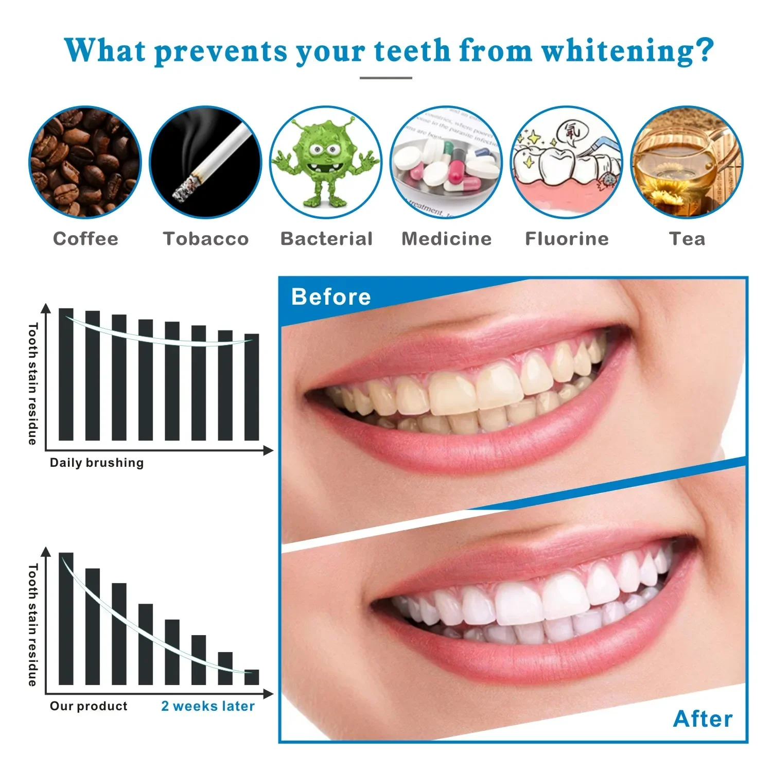 14/28pcs 3D Teeth Whitening St - Whitening Strip 3D 리뷰 및 가격
