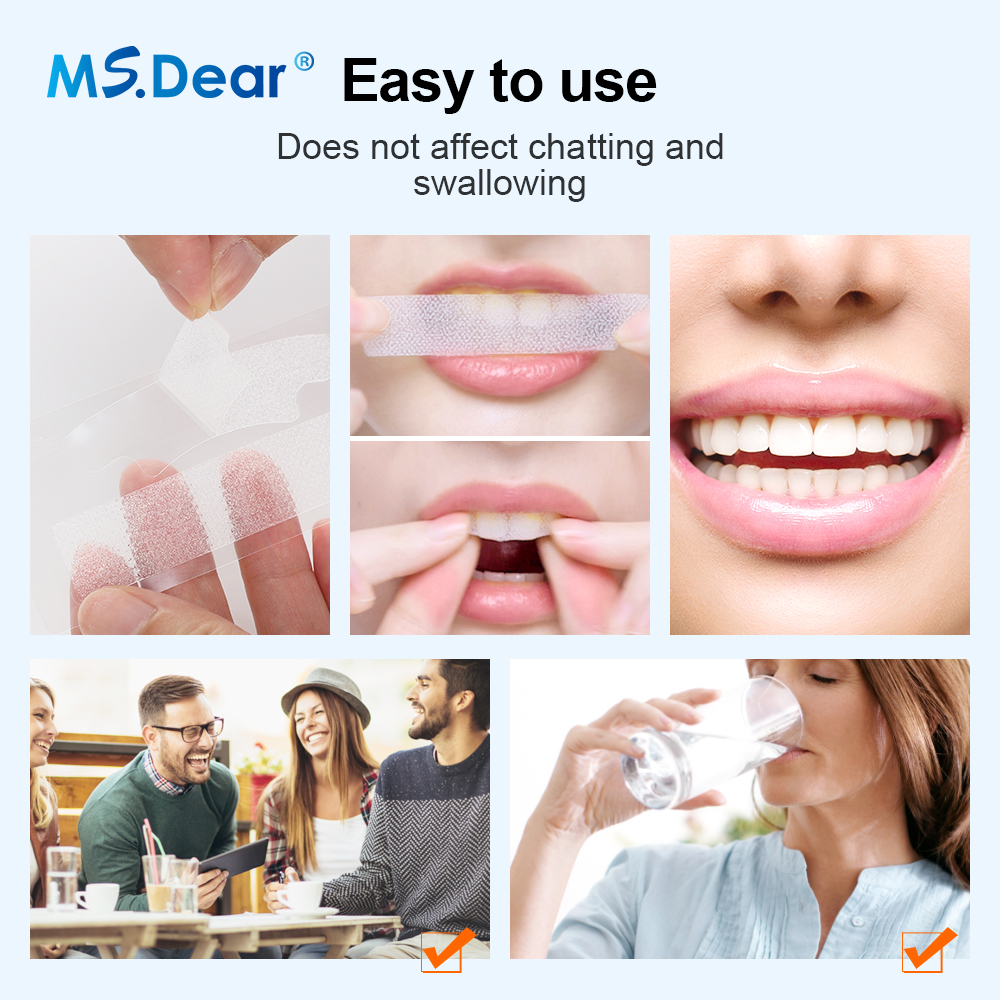 Teeth Whitening Strips Cleansi - Teeth Whitening Foam 리뷰 및 가격